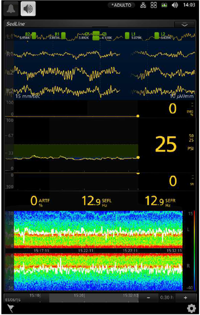 Monitorização Cerebral