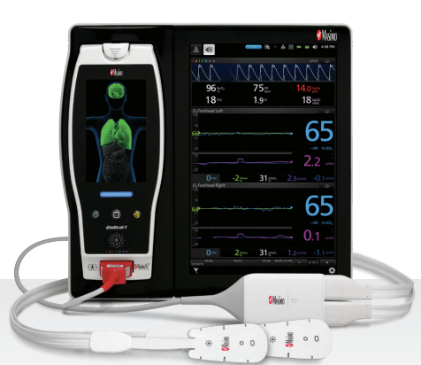 Oximetria Regional Cerebral