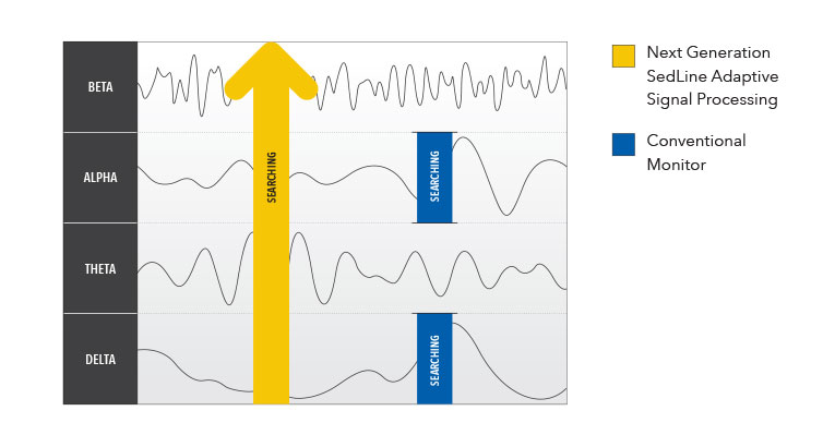 Processamento de sinal adaptativo