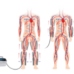 CM_SCD600_Sistema_Compressao_1